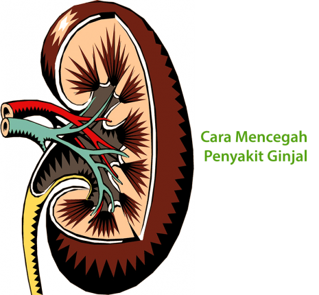 Cara Mencegah Penyakit Ginjal